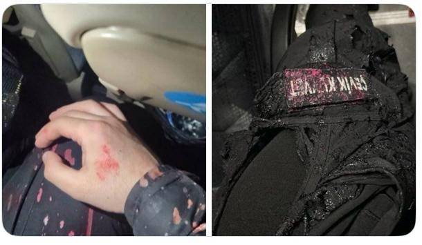 Özgür Özel'in sokağa davet ettiği göstericiler polisin üzerine asit attı 2