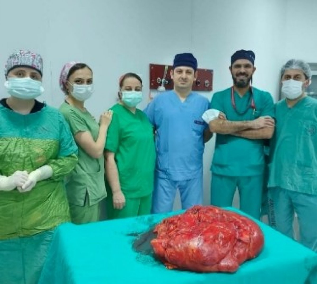 Karın ağrısı şikayetiyle gitti, 21 kiloluk tümor çıkarıldı
