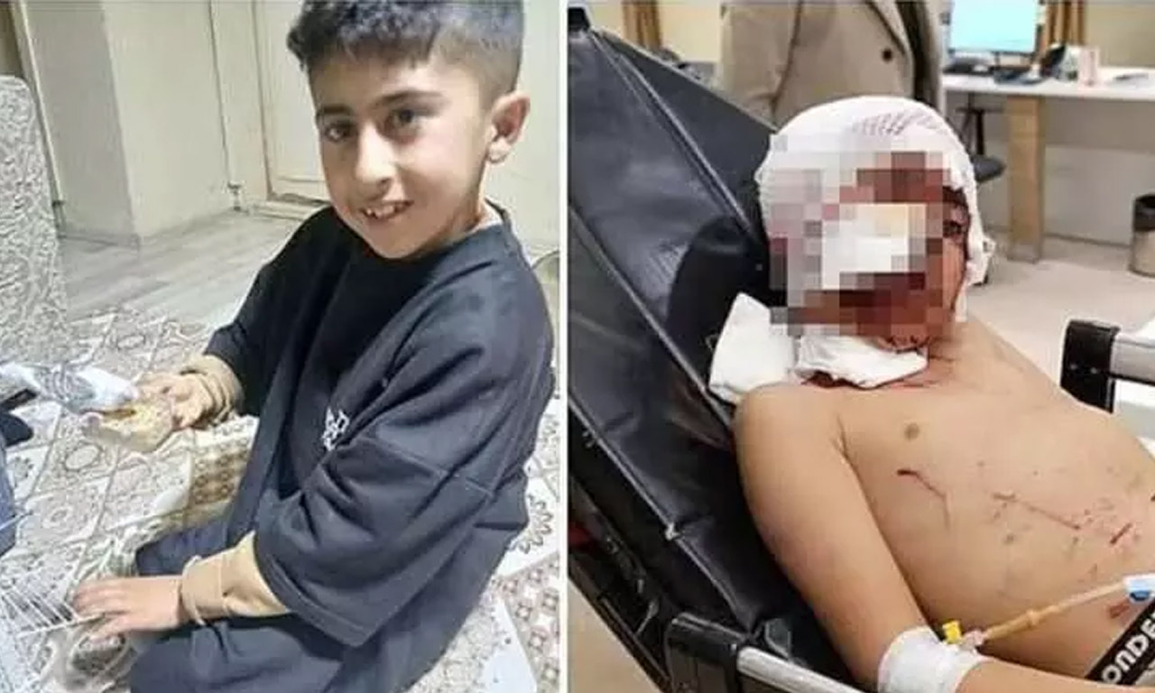 Erzurum'da dehşet: Bir küçük can daha başıboş köpeklerin pençeleriyle parçalandı!