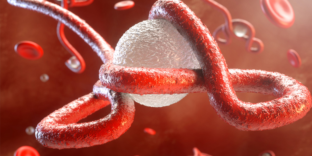 Ebola nedir?